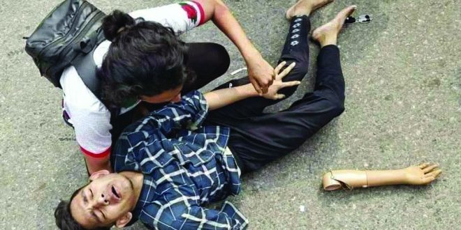 ‘আমার এক হাত নাই, কৃত্রিম হাত, এটাও ওরা ভেঙে ফেলেছে’