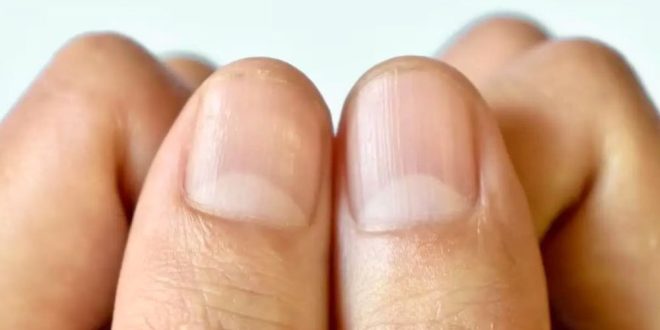 নখের গোড়ায় অর্ধ চাঁদ কিসের লক্ষণ?